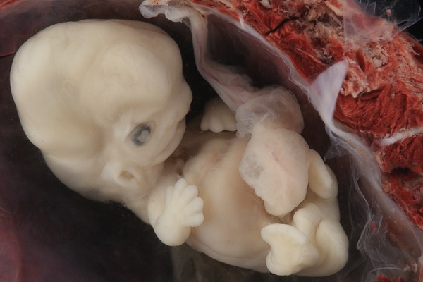 humanembryo67weeks